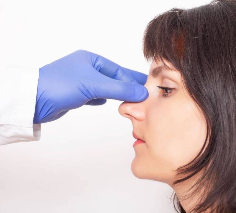 Rhinoplastie