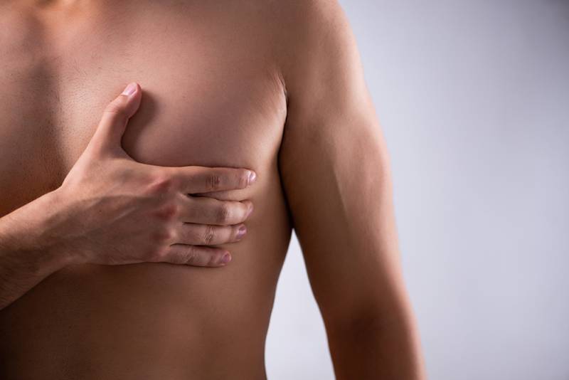 Gynécomastie - chirurgie esthétique chez l'homme